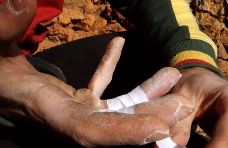 Treat finger injuries - climbing