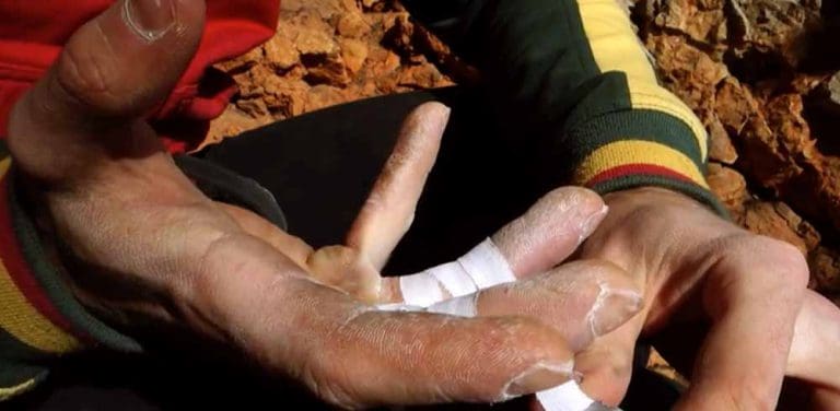 Fingerverletzungen behandeln - Klettern